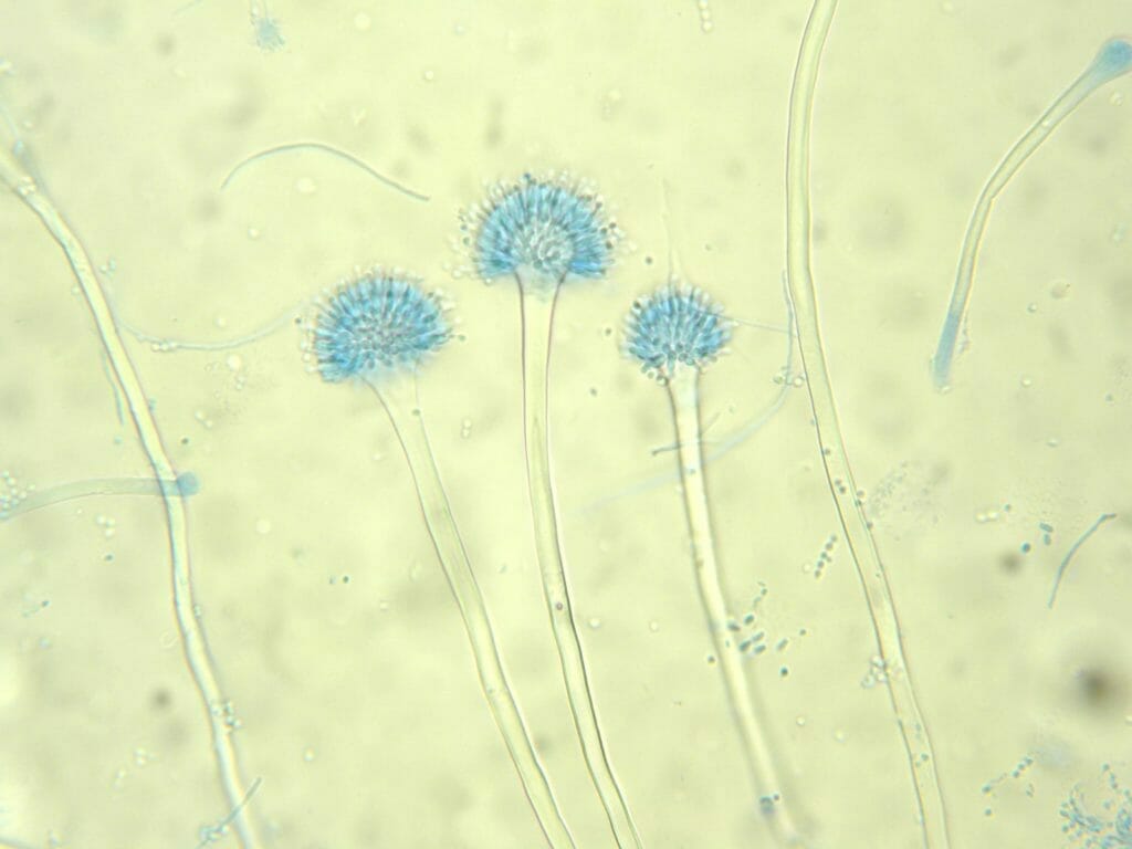 菌類の顕微鏡写真